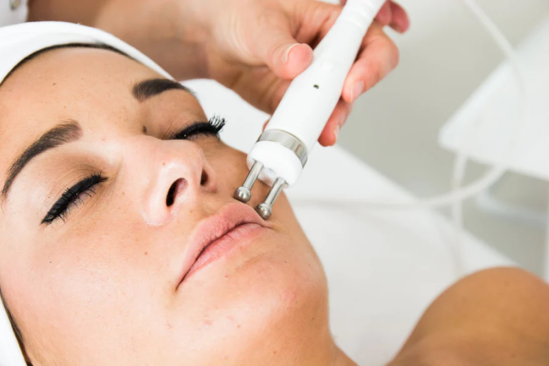 LES RADIOFREQUENCES POUR LE VISAGE A STRASBOURG